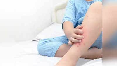 baby eczema : குழந்தைக்கு தோல் அழற்சி, அறிகுறிகளும் காரணங்களும்? பெற்றோர்களுக்கானது!