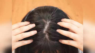 Black Hair: வெள்ளை முடியை கருப்பாக்கலாம், யாருக்கெல்லாம் பலன் கொடுக்கும், ஆய்வு சொல்வது என்ன?