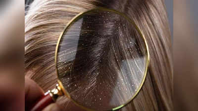hair care tips: குளிர்காலத்தில் ஏன் அதிகமாக பொடுகு உண்டாகிறது?
