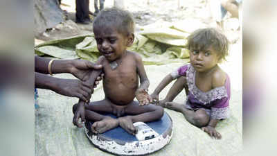 Mumbai News: मुंबई शहर में 4,000 से अधिक बच्चे गंभीर कुपोषण के शिकार