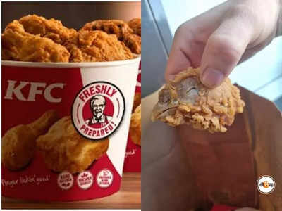 KFC-র হট উইংসে আস্ত মুরগির মাথা! সমালোচনার ঝড়