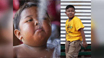 हर दिन 40 सिगरेट पीता था मात्र 2 साल का यह चेन स्‍मोकर बच्‍चा, छोड़ा तो बदली सूरत