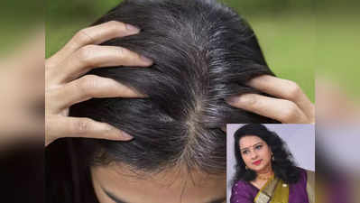 white hair problems : வெள்ளை முடி தீவிரமாகாமல் தடுக்க 3 விஷயம் ஃபாலோ பண்ணுங்க, நிபுணர் தரும் பயனுள்ள குறிப்புகள்!