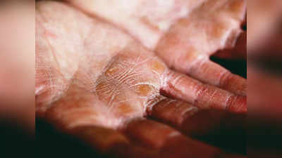Hand Care Tips: सर्दियों में फट रहे हैं आपके हाथ, तो रोजाना करें ये काम