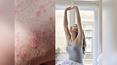 Skin Problem: अंडरआर्म्स के पिंपल्स से मिलेगी राहत, बस इन 5 बातों का रखें ख्याल