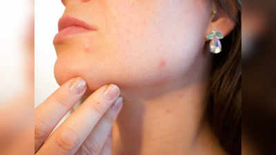 Skin cancer symptoms: आपके कान-मुंह, गर्दन पर नजर आ सकते हैं स्किन कैंसर के ये 5 गंभीर लक्षण, समझें और करें बचाव