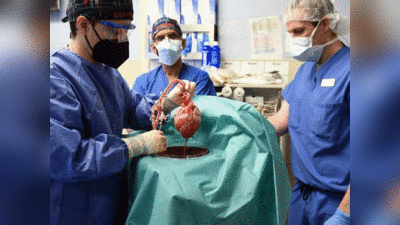 अमेरिकी डॉक्‍टरों ने रचा इतिहास, दुनिया में पहली बार इंसान के अंदर लगाया सूअर का दिल