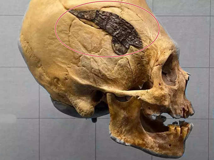 Peruvian man skull