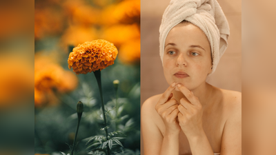 Marigold flower for face: मुंहासों की समस्या को ठीक कर चेहरे पर लाएगा निखार, ट्राई करें गेंदे के फूल से बना ये फेस पैक