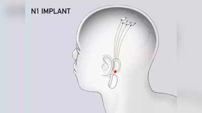 Neuralink: कमालच झाली! आता मानवी मेंदूत बसवणार ‘चिप’, जुन्या आठवणींना नवीन शरीरात देखील करता येईल ट्रान्सफर