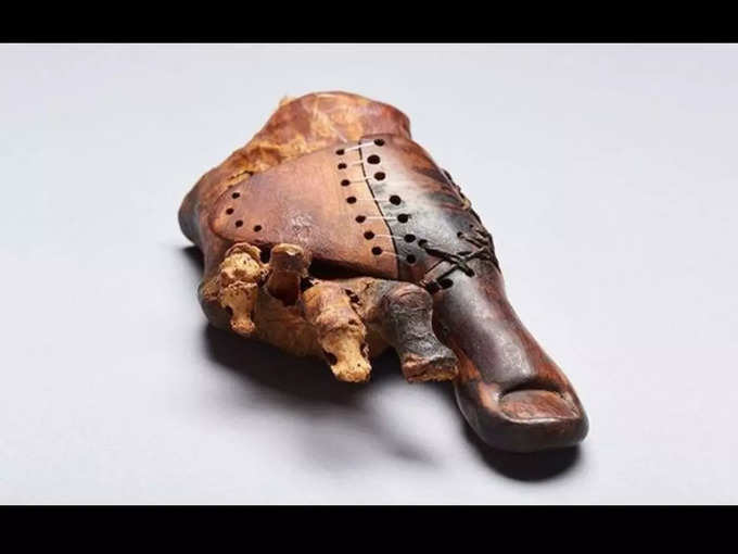 ఇదో మమ్మీ కాలు. 3వేల ఏళ్ల నాటిది. ఈ కాలుకు ప్రాస్థెసిస్ వేలు (toe prosthesis) ఉంది.