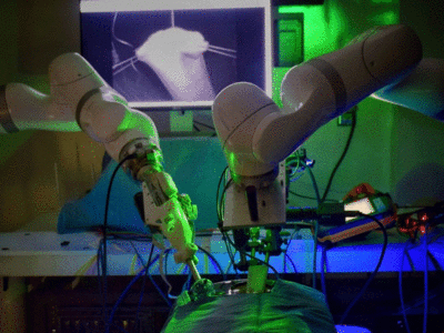 Robot Surgery: दुनिया में पहली बार बिना इंसानी मदद के रोबोट ने की सफलतापूर्वक सर्जरी, रचा इतिहास