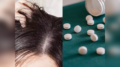 Aspirin Uses For Hair: डैंड्रफ के साथ-साथ कई हेयर प्रॉब्लम का इलाज है एस्पिरिन की गोलियां, बस इस तरीके से करें इस्तेमाल