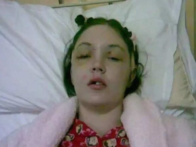 woman loses her forhead in car accident news in hindi