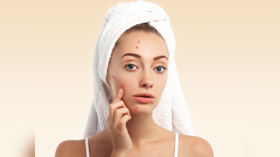 Skin Problems: पिंपल हो या फिर चेहरे पर रैशेज, देसी नुस्खे आजमाने से पहले जान लें एक्सपर्ट की राय