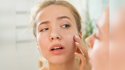 Sensitive Skin Care Tips: आपकी सेंसिटिव स्किन पर नहीं होगी जलन की समस्या, बस एक्सपर्ट के बताई इन 4 टिप्स को करें फॉलो