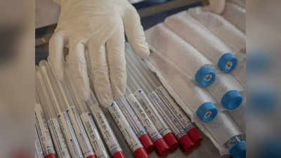 coronavirus update करोना: राज्यात आज रुग्णसंख्येसह मृत्यूही वाढले; २० हजारांवर रुग्ण झाले बरे