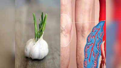 Garlic benefits: लहसुन को 5 दिन अंकुरित करके खाएं, जड़ से खत्म होने लगेंगी ये 5 गंभीर बीमारियां