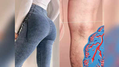 Health tips: दिनभर फिटिंग Jeans पहनने से हो सकती हैं 5 गंभीर बीमारियां, लड़कियां ध्यान दें