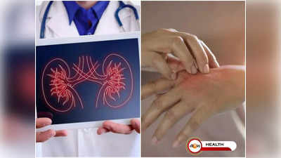 Kidney Disease Symptoms: ত্বকেও দেখা দিতে পারে কিডনির অসুখের লক্ষণ! জানুন দ্রুত