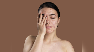 Acne Treatment: इन 5 हेल्दी ड्रिंक्स से हफ्ते भर में चेहरे से गायब होने लगेंगे मुंहासे, फेस पर देखने को मिलेगा नेचुरल ग्लो