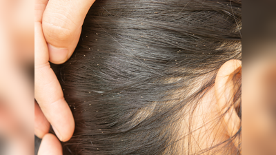Tips To Remove Nits From Hair: इन 5 घरेलू चीजों से मिट जाएगा लीख का नामो निशान, एक ही दिन में मिलेगा इससे छुटकारा