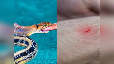 Snake bite treatment: सांप के काटने से देश में हर साल मरते हैं 50 हजार लोग, ऐसा होने पर तुरंत करें 5 काम