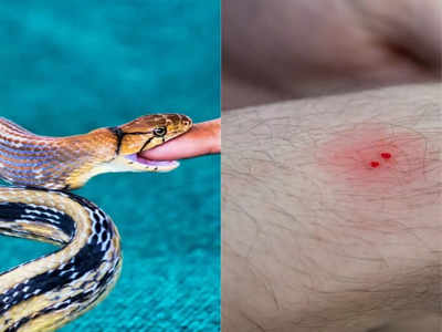 Snake bite treatment: सांप के काटने से देश में हर साल मरते हैं 50 हजार लोग, ऐसा होने पर तुरंत करें 5 काम