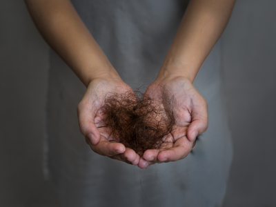 Hair Fall: आयुर्वेदिक तेल-शैंपू सब कुछ ट्राई करने के बाद भी झड़ रहे हैं बाल? आज से ही फॉलो करें एक्सपर्ट की ये खास टिप्स 