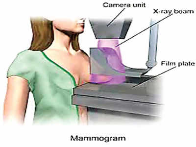 women health: பெண்கள் 40 வயதுக்குமேல் ஆண்டுதோறும் மெமோகிராம் சோதனை ஏன் செய்ய வேண்டும்...