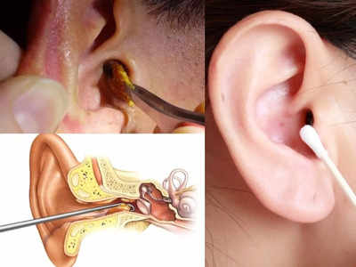 Ear wax removal tip: कान का मैल तुरंत निकलेगा बाहर, Harvard ने बताया जिद्दी मैल को निकालने का आसान उपाय