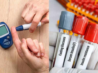 Diabetes test at home: लैब के 500 रुपये बचाएं, घर बैठे इन 5 तरीकों से करें Blood Sugar की जांच, रिपोर्ट भी आएगी सटीक