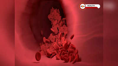 High Cholesterol: এই ৫ উপায়ে দ্রুত কমবে কোলেস্টেরল! জানুন কৌশল