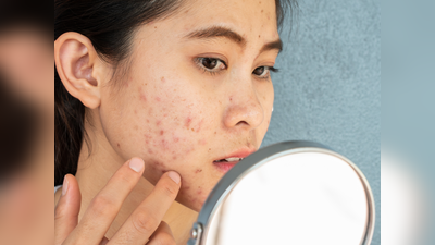 Beauty Tips For Oily Skin: ऑयली स्किन वाले भूलकर भी ना करें ये 5 गलतियां, पिंपल और दाग-धब्बों से भर जाएगा चेहरा