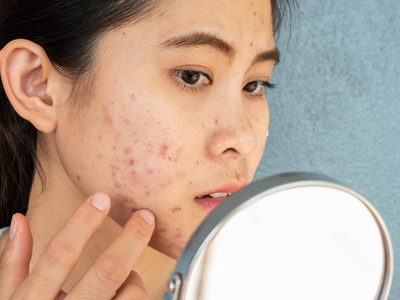 Beauty Tips For Oily Skin: ऑयली स्किन वाले भूलकर भी ना करें ये 5 गलतियां, पिंपल और दाग-धब्बों से भर जाएगा चेहरा