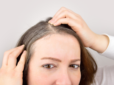 Hair Care tips: प्याज के छिलकों को कचरा समझने की ना करें गलती, तेजी से बाल बढ़ाने के साथ-साथ सफेद बालों का भी होगा इलाज