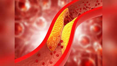 Cholesterol: वैज्ञानिकों ने खोज लिया शरीर से खराब कोलेस्ट्रॉल निकालने का सबसे सस्ता-आसान तरीका, मौत का जोखिम भी होगा 13% कम