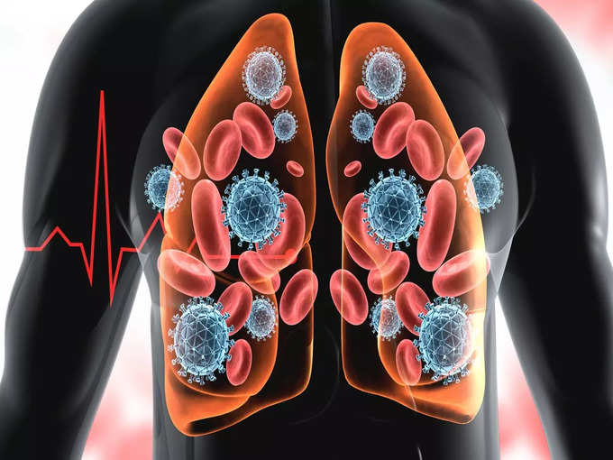 टीबी क्या है (What is tuberculosis)