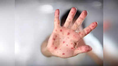 Infectious Diseases: ની જેમ સંક્રામક છે આ 4 રોગ, છીંક-ઉધરસ સહિત જકડી લે છે શરીર