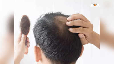 Hair Fall Solution: শুধু চুল পড়া বন্ধ নয়, গজাবে নতুন চুলও! উপায় বাতলে দিলেন চিকিৎসক তসনিম জারা
