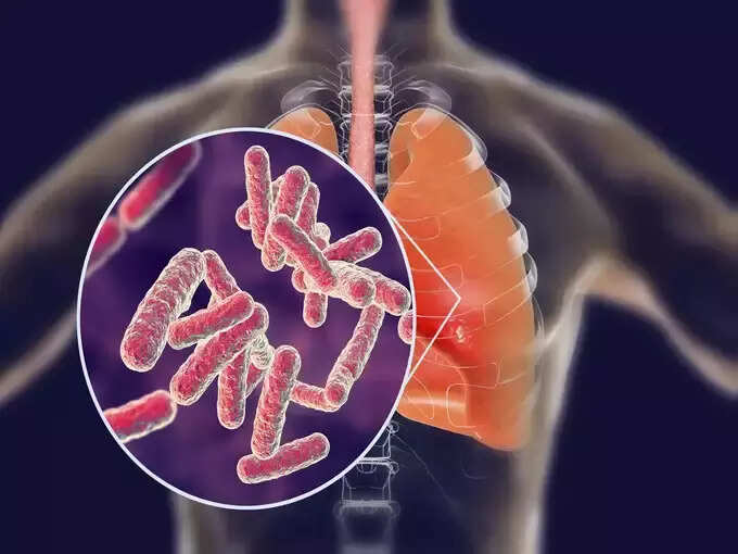 ​ટીબીના લક્ષણો: (Symptoms of TB)