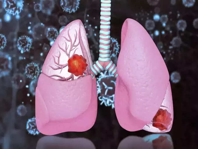 ​ટીબી રોગનું કારણ શું છે? (causes tuberculosis)