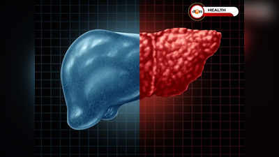 Liver Problem: এই কয়েকটি কারণেই ১২টা বাজে লিভারের! জানা থাকুক