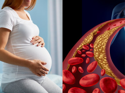 Pregnancy tips: पूरे 9 महीने की प्रेगनेंसी पर पानी फेर सकता है Cholesterol, इन 5 तरीकों से कम करें खराब कोलेस्ट्रॉल