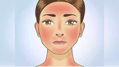 skin rashes :  வெப்பத்தினால் வரும் ஸ்கின் ரேஷஷ்  தடுக்க என்னலாம் செய்யணும் தெரியுமா?