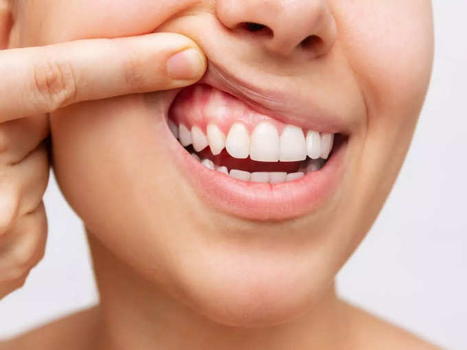 मुंह, दांत और मसूड़ों में दिख रहे कोरोना के लक्षण