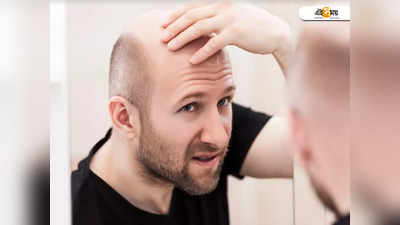 Hair Care Tips For Men: অল্প বয়সে টাক পড়ছে? পুরুষদের চুল পড়া বন্ধ করতে কাজে লাগবে এই টিপস