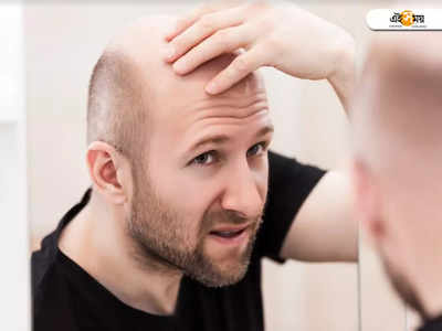 Hair Care Tips For Men: অল্প বয়সে টাক পড়ছে? পুরুষদের চুল পড়া বন্ধ করতে কাজে লাগবে এই টিপস