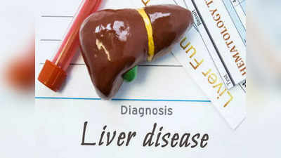 liver health : இந்த சின்ன சின்ன விஷயம் கூட உங்க கல்லீரலை காலி பண்ணிடுமாம், ஜாக்கிரதை!