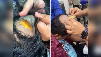 तीस मार खां बन रहा था गोल्ड स्मगलर, कस्टम अधिकारियों ने बाल खींचकर निकाला ₹30.55 लाख का सोना!